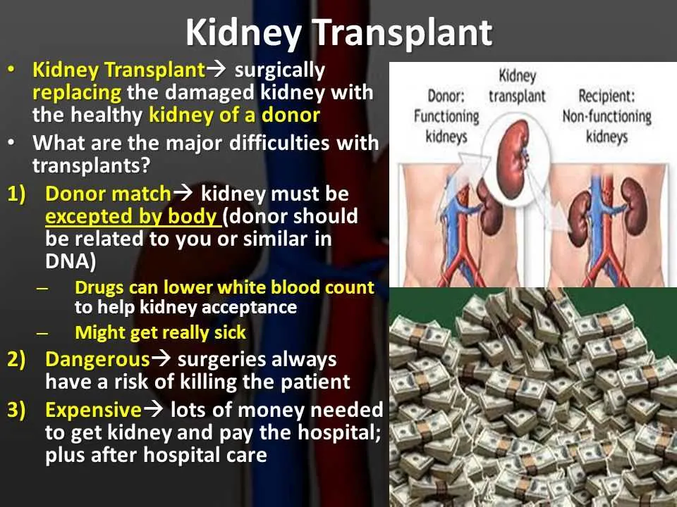 kidney transplant anniversary message